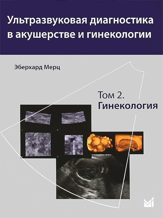 Ультразвуковая диагностика в акушерстве и гинекологии. Том 2